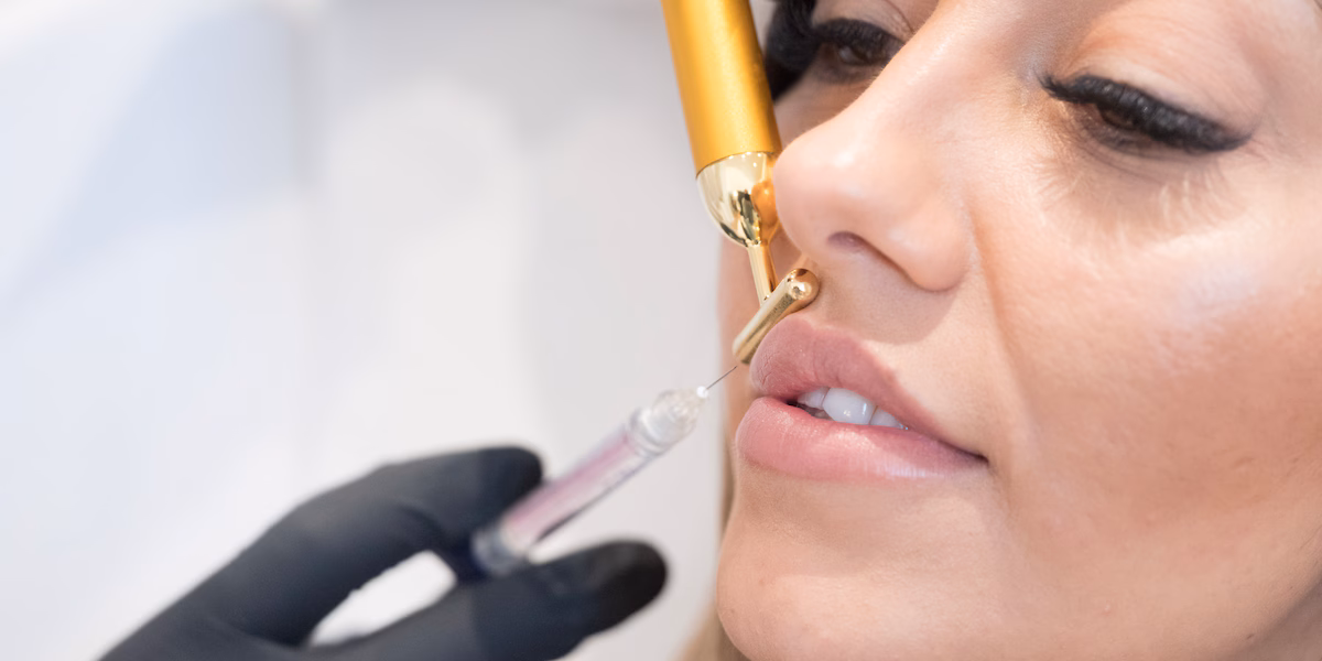 Lippen Aufspritzen Nürnberg: Volle Lippen, die begeistern